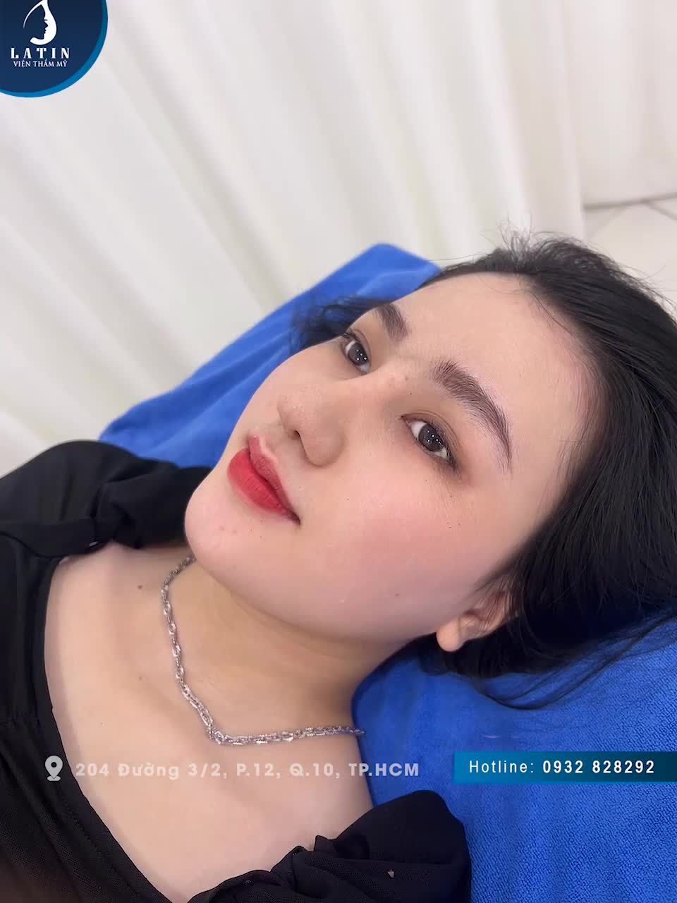 XINH NHƯ HOT GIRL SAU 12 NGÀY NÂNG MŨI LATIN